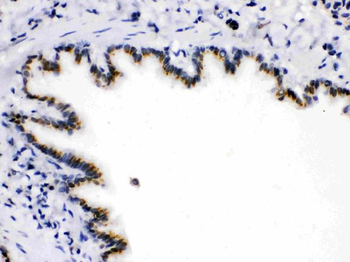 Anti-ARSA Antibody