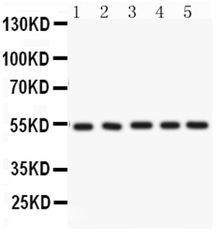 Anti-ARSA Antibody