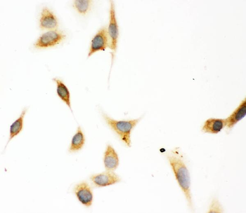 Anti-Aspartate beta hydroxylase/ASPH Antibody