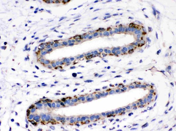 Anti-Aspartate beta hydroxylase/ASPH Antibody