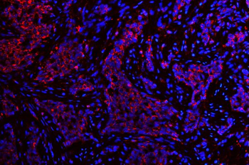 Anti-ATG14L Antibody