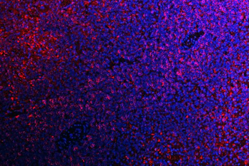 Anti-ATG14L Antibody