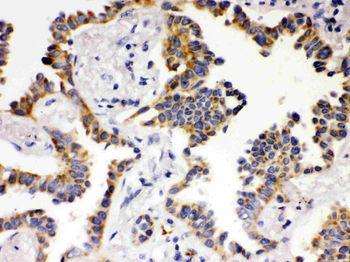 Anti-ATG14L Antibody