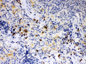 Anti-ATG14L Antibody