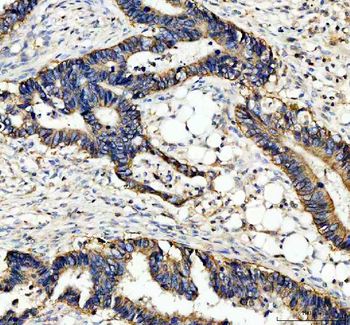 alpha 1 Sodium Potassium ATPase/ATP1A1 Antibody