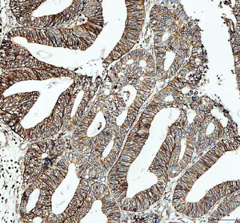 Anti-alpha 1 Sodium Potassium ATPase/ATP1A1 Antibody