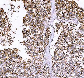 Anti-alpha 1 Sodium Potassium ATPase/ATP1A1 Antibody