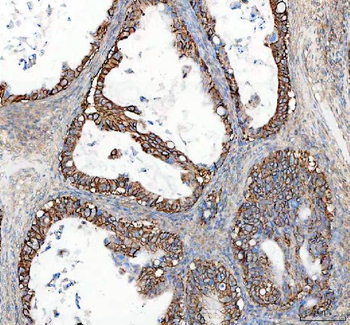Anti-alpha 1 Sodium Potassium ATPase/ATP1A1 Antibody
