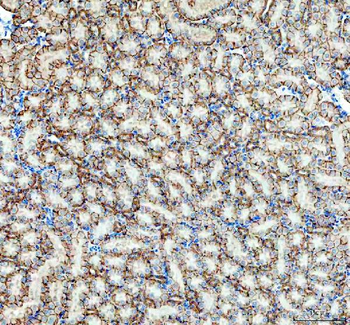 Anti-alpha 1 Sodium Potassium ATPase/ATP1A1 Antibody