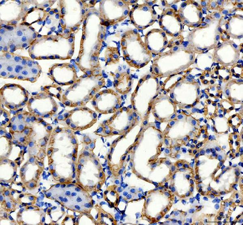 Anti-alpha 1 Sodium Potassium ATPase/ATP1A1 Antibody