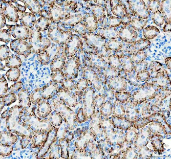 Anti-alpha 1 Sodium Potassium ATPase/ATP1A1 Antibody