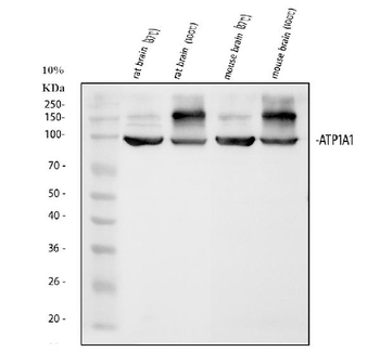 Anti-alpha 1 Sodium Potassium ATPase/ATP1A1 Antibody
