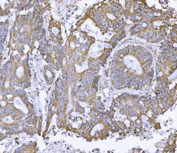 Anti-ATX2/ATXN2 Antibody