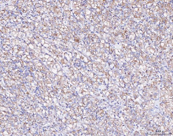 Anti-ATX2/ATXN2 Antibody