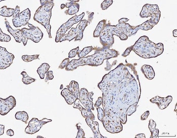 Anti-ATX2/ATXN2 Antibody