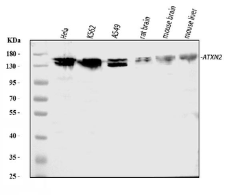 Anti-ATX2/ATXN2 Antibody