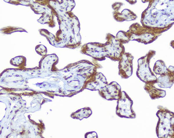 Anti-CD46 Antibody