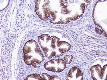 Anti-CD46 Antibody