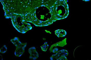 Anti-CD55 Antibody