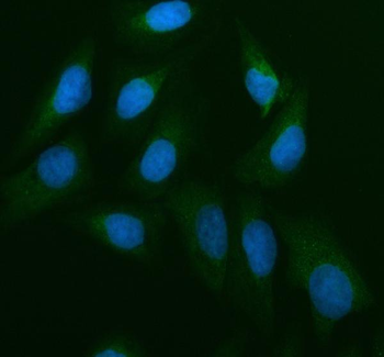Anti-Cdc25B Antibody