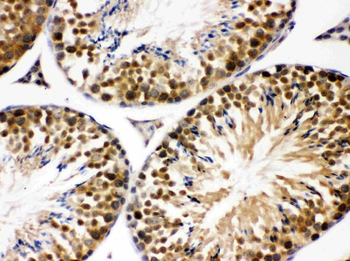 Anti-JAB1/COPS5 Antibody