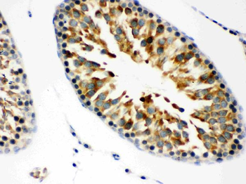 Anti-JAB1/COPS5 Antibody