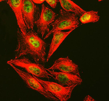 Anti-CTCF Antibody