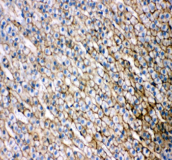 Anti-Scavenging Receptor SR-BI/SCARB1 Antibody