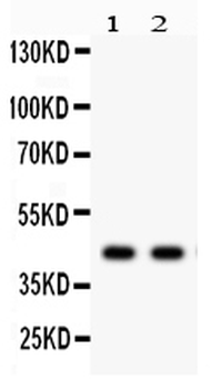 alpha Sarcoglycan/SGCA Antibody