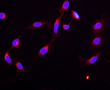 Anti-STAT5b Antibody