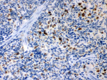 Anti-TNF Receptor II/TNFRSF1B Antibody