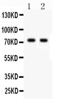 Anti-TNF Receptor II/TNFRSF1B Antibody