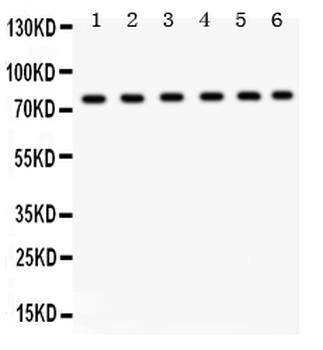 TRPV5 Antibody