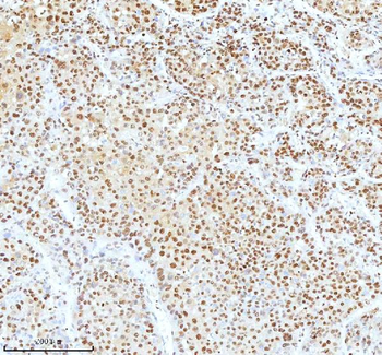 Anti-Ku70/XRCC6 Antibody