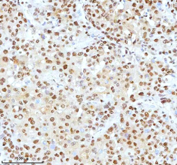 Anti-Ku70/XRCC6 Antibody