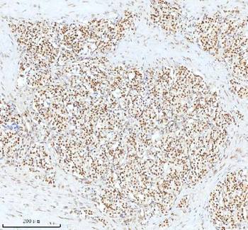 Anti-Ku70/XRCC6 Antibody