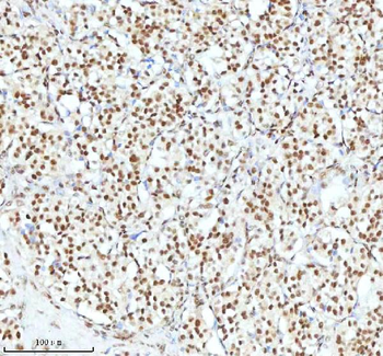Anti-Ku70/XRCC6 Antibody