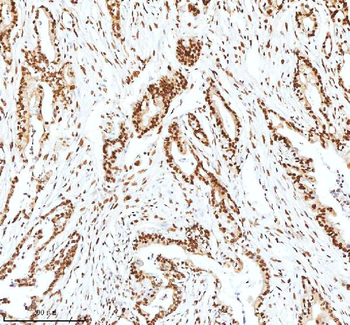 Anti-Ku70/XRCC6 Antibody