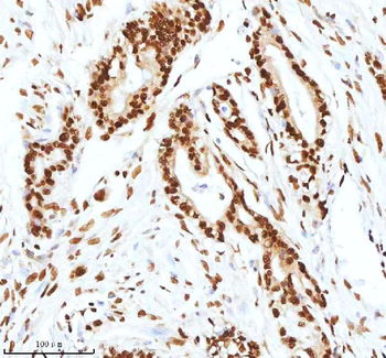 Anti-Ku70/XRCC6 Antibody