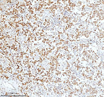 Anti-Ku70/XRCC6 Antibody