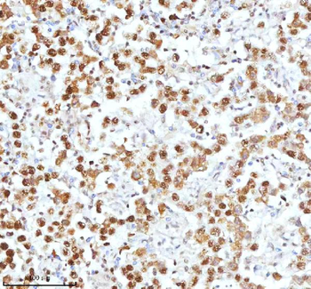 Anti-Ku70/XRCC6 Antibody