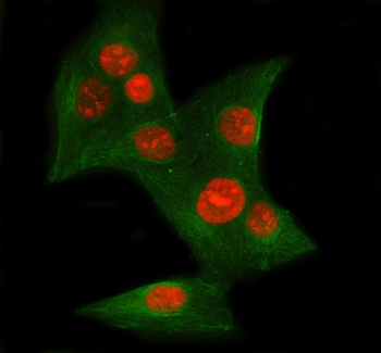Anti-Ku70/XRCC6 Antibody