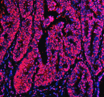 Anti-Ku70/XRCC6 Antibody