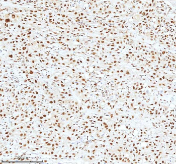 Anti-Ku70/XRCC6 Antibody
