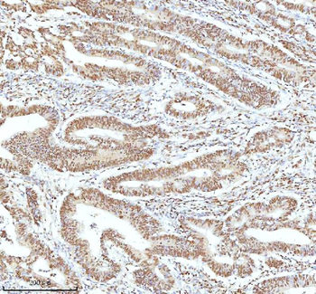 Anti-Ku70/XRCC6 Antibody