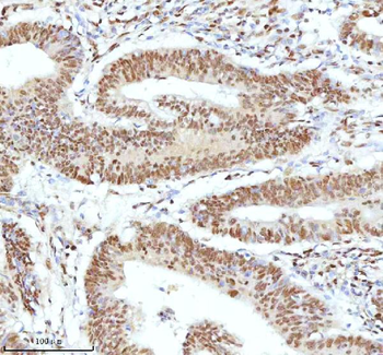 Anti-Ku70/XRCC6 Antibody