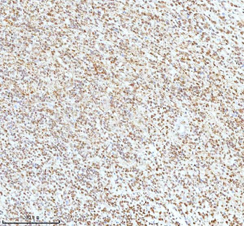 Anti-Ku70/XRCC6 Antibody