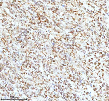 Anti-Ku70/XRCC6 Antibody