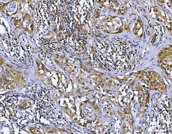 Bcl10 Rabbit Polyclonal Antibody