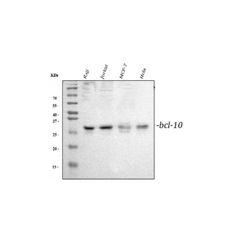 Bcl10 Rabbit Polyclonal Antibody